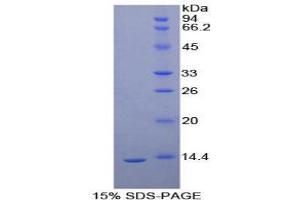 SDS-PAGE (SDS) image for Hepatitis A Virus Cellular Receptor 1 (HAVCR1) (AA 23-125) protein (His tag) (ABIN2121487)
