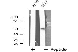 Western blot analysis of extracts from A549 cells, using CXG2 antibody. (GJC2 Antikörper  (N-Term))