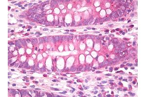 Anti-CB1 antibody IHC of human colon. (CNR1 Antikörper)