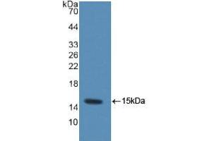 Western blot analysis of recombinant Rat MRP1. (MRP1 Antikörper  (AA 21-115))