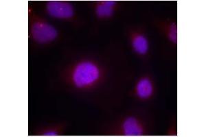 Image no. 2 for anti-Cyclin B1 (CCNB1) (pSer147) antibody (ABIN401595) (Cyclin B1 Antikörper  (pSer147))