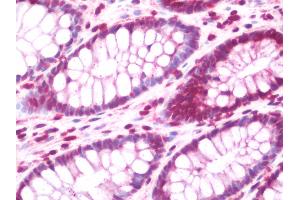 Anti-FOXP1 antibody IHC staining of human colon.