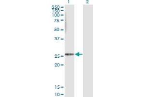 Western Blot analysis of HLA-DMB expression in transfected 293T cell line by HLA-DMB monoclonal antibody (M08), clone 4D12. (HLA-DMB Antikörper  (AA 22-129))