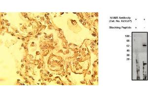 Image no. 1 for anti-Numb Homolog (NUMB) antibody (ABIN793714) (NUMB Antikörper)