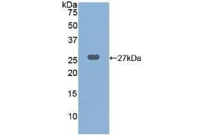 Detection of Recombinant CTSK, Human using Polyclonal Antibody to Cathepsin K (CTSK) (Cathepsin K Antikörper  (AA 115-329))