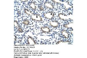 Rabbit Anti-KRT18 Antibody  Paraffin Embedded Tissue: Human Lung Cellular Data: Alveolar cells Antibody Concentration: 4. (Cytokeratin 18 Antikörper  (C-Term))
