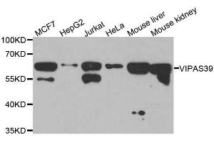 Western blot analysis of extracts of various cell lines, using VIPAS39 antibody. (VIPAR Antikörper  (AA 1-220))