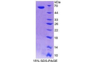 SDS-PAGE (SDS) image for Inhibin, beta E (INHBE) (AA 102-344) protein (His tag,GST tag) (ABIN1980627) (INHBE Protein (AA 102-344) (His tag,GST tag))