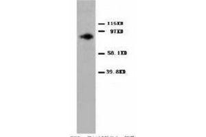 Image no. 2 for anti-Protein Kinase C, alpha (PKCa) (C-Term) antibody (ABIN1492930) (PKC alpha Antikörper  (C-Term))