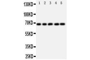 Western Blotting (WB) image for anti-Protein tyrosine Phosphatase, Non-Receptor Type 11 (PTPN11) (AA 582-597), (C-Term) antibody (ABIN3044088)