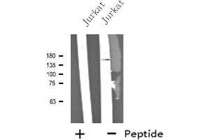 Western blot analysis of extracts from Jurkat cells, using NCAN antibody. (Neurocan Antikörper  (Internal Region))