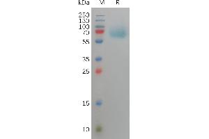 SDS-PAGE (SDS) image for Fibroblast Growth Factor Receptor 3 (FGFR3) (AA 23-375) protein (His tag) (ABIN7491227)
