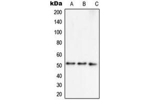 Western blot analysis of Septin 7 expression in MCF7 (A), HepG2 (B), NIH3T3 (C) whole cell lysates. (Septin 7 Antikörper  (C-Term))