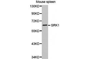Western Blotting (WB) image for anti-G Protein-Coupled Receptor Kinase 1 (GRK1) (AA 1-160) antibody (ABIN3023688) (GRK1 Antikörper  (AA 1-160))