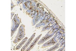 IHC analysis of COPE using anti-COPE antibody (ABIN7602509).