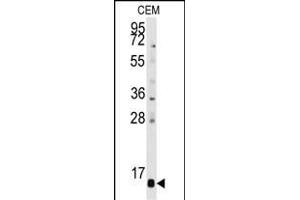 Western blot analysis of anti-PFDN6 Antibody (N-term) (ABIN389346 and ABIN2839455) in CEM cell line lysates (35 μg/lane). (PFDN6 Antikörper  (N-Term))