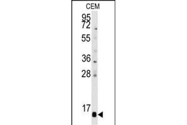 PFDN6 antibody  (N-Term)