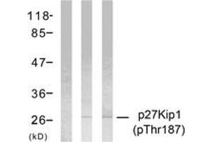 Western blot analysis of extracts from HeLa cells treated with EGF or IFN-alpha, using p27 Kip1 (Phospho-Thr187) Antibody. (CDKN1B Antikörper  (pThr187))