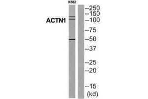 Western blot analysis of extracts from K562 cells, using ACTN1 antibody. (ACTN1 Antikörper  (N-Term))