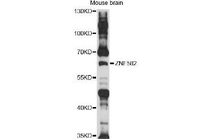 Western blot analysis of extracts of mouse brain, using ZNF582 antibody (ABIN6292528) at 1:1000 dilution.