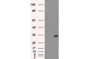 HEK293T cells were transfected with the pCMV6-ENTRY control (Left lane) or pCMV6-ENTRY AKR1A1 (Right lane) cDNA for 48 hrs and lysed. (AKR1A1 Antikörper)