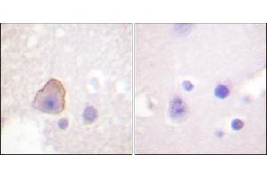 Immunohistochemical analysis of paraffin-embedded human brain tissue using ADD1 (Ab-726) antibody.