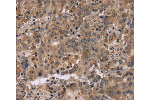 Immunohistochemistry (IHC) image for anti-Family with Sequence Similarity 107, Member A (FAM107A) antibody (ABIN2423423) (FAM107A Antikörper)