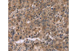 Immunohistochemistry (IHC) image for anti-Family with Sequence Similarity 107, Member A (FAM107A) antibody (ABIN5544390) (FAM107A Antikörper)