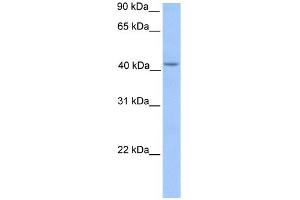 WB Suggested Anti-HMBS Antibody Titration: 0.