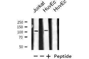 Western blot analysis of extracts from Jurkat/HuvEc cells, using PKN1/PRK1 antibody. (PKN1 Antikörper  (Internal Region))
