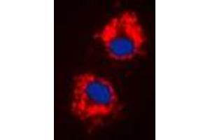 Immunofluorescent analysis of Cytochrome P450 1A1/2 staining in HeLa cells. (CYP1A1/2 Antikörper  (Center))