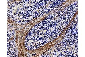 Immunohistochemistry analysis of paraffin-embedded rat spleen using LDLR Polyclonal Antibody at dilution of 1:300. (LDLR Antikörper)