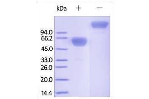 Cynomolgus PD-1, Fc Tag on SDS-PAGE under reducing (R) and no-reducing (NR) conditions. (PD-1 Protein (AA 25-167) (Fc Tag))