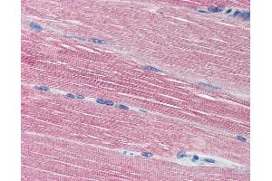Anti-Acetylcholinesterase antibody IHC of human skeletal muscle. (Acetylcholinesterase Antikörper  (N-Term))