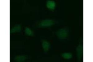 Immunofluorescent staining of HeLa cells with GLB1 monoclonal antibody, clone 10B2 .