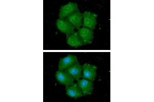 ICC/IF analysis of HSPA13 in Hep3B cells. (HSPA13 Antikörper  (AA 23-471))