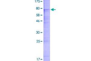 Image no. 1 for Acrosin (ACR) (AA 1-421) protein (GST tag) (ABIN1305697) (Acrosin Protein (ACR) (AA 1-421) (GST tag))