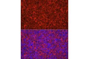 Immunofluorescence analysis of rat adrenal gland using CYP11 Rabbit pAb (713) at dilution of 1:100 (40x lens). (CYP11A1 Antikörper  (AA 40-320))