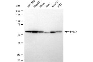 Western blotting analysis using PKM2 antibody (ABIN7800085).