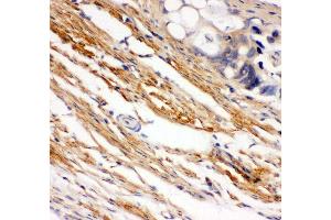 Anti- C-Kit Picoband antibody, IHC(P) IHC(P): Human Intestinal Cancer Tissue (KIT Antikörper  (AA 26-285))