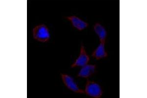 Immunofluorescence analysis of POU5F1 polyclonal antibody  in HeLa cells. (OCT4 Antikörper  (Glu125))