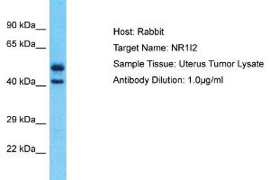 Host: Rabbit Target Name: NR1I2 Sample Type: Uterus Tumor lysates Antibody Dilution: 1. (NR1I2 Antikörper  (N-Term))