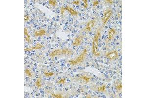 Immunohistochemistry of paraffin-embedded rat kidney using UBE2B Antibody. (UBE2B Antikörper  (AA 1-152))