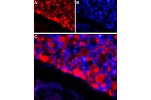 Expression of NaVβ4 in rat DRGImmunohistochemical staining of adult rat dorsal root ganglion (DRG) using Anti-SCN4B (NaVβ4) (extracellular) Antibody (ABIN7237813, ABIN7316730 and ABIN7316731) followed by goat anti-rabbit-AlexaFluor-594 secondary antibody.