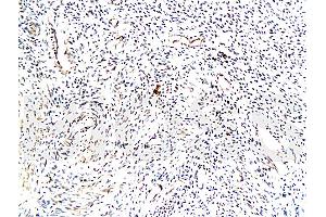 Formalin-fixed and paraffin embedded: human endometrium Anti-TrK-A/NTRK1 Polyclonal Antibody (ABIN726110), Unconjugated at 1:200 followed by conjugation to the secondary antibody and DAB staining (TRKA Antikörper  (AA 725-821))