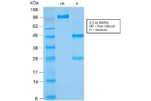 SDS-PAGE Analysis of Purified BCL2 Mouse Recombinant Monoclonal Antibody ABIN6383839. (Rekombinanter Bcl-2 Antikörper)