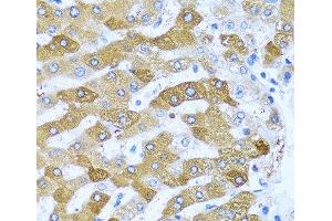 Immunohistochemistry of paraffin-embedded Human liver using IFIT3 Polyclonal Antibody at dilution of 1:100 (40x lens). (IFIT3 Antikörper)