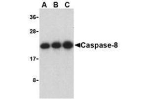 Western blot analysis of caspase-8 in Jurkat cell lysate with AP30203PU-N caspase-8 antibody at (A) 0. (Caspase 8 Antikörper  (C-Term))