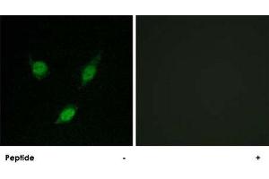 Immunofluorescence analysis of MCF-7 cells, using TACC1 polyclonal antibody . (TACC1 Antikörper  (N-Term))