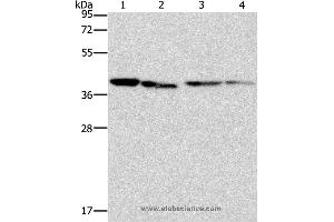 Western blot analysis of Human placenta tissue and NIH/3T3 cell, Raji and hepG2 cell, using BCAT2 Polyclonal Antibody at dilution of 1:312. (BCAT2 Antikörper)